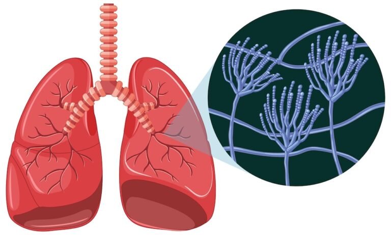 Step-by-Step Guide to Lung Cancer Treatment in Karol Bagh.