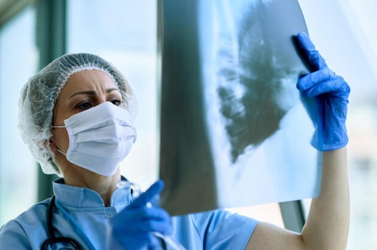 Best Lung biopsy treatment in Dwarka
