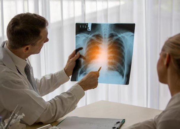 Best Lung Cancer Treatment in Dwarka