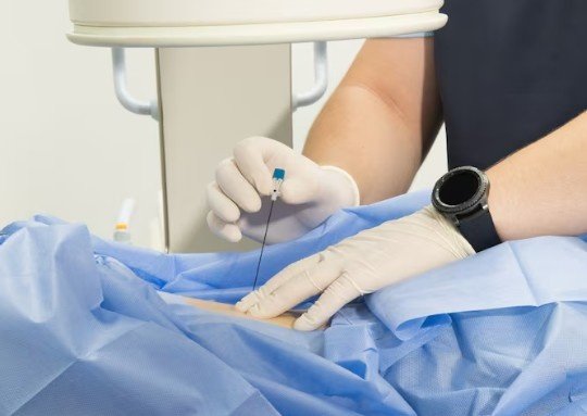 Best Cryo-Lung Biopsies Treatment in Lajpat Nagar