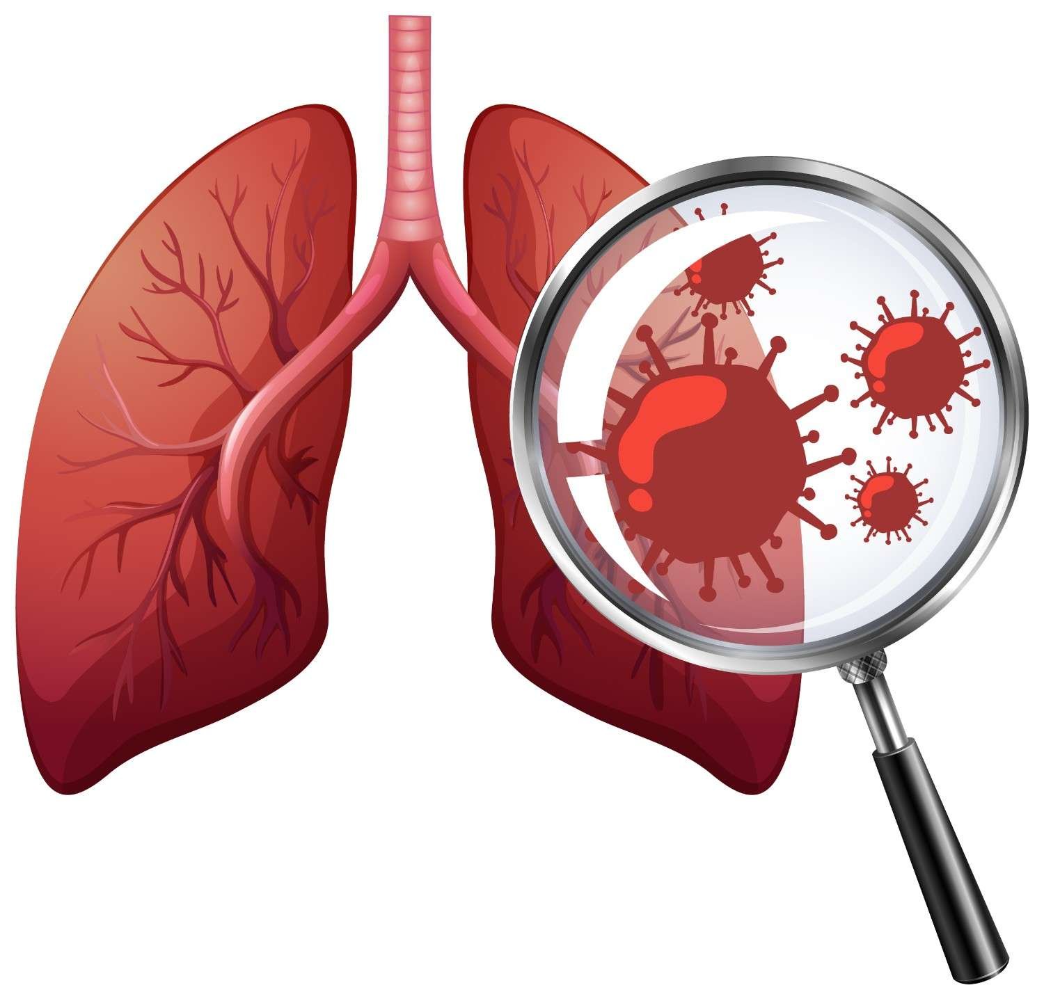 Best Doctor for Tuberculosis in South Delhi